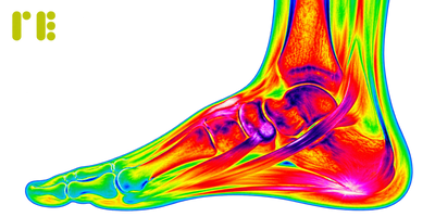 Your Knee, Hip, or Back Hurts. But the Real Problem Is in Your Shoes.