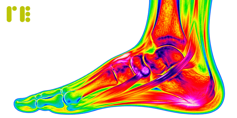 Your Knee, Hip, or Back Hurts. But the Real Problem Is in Your Shoes.