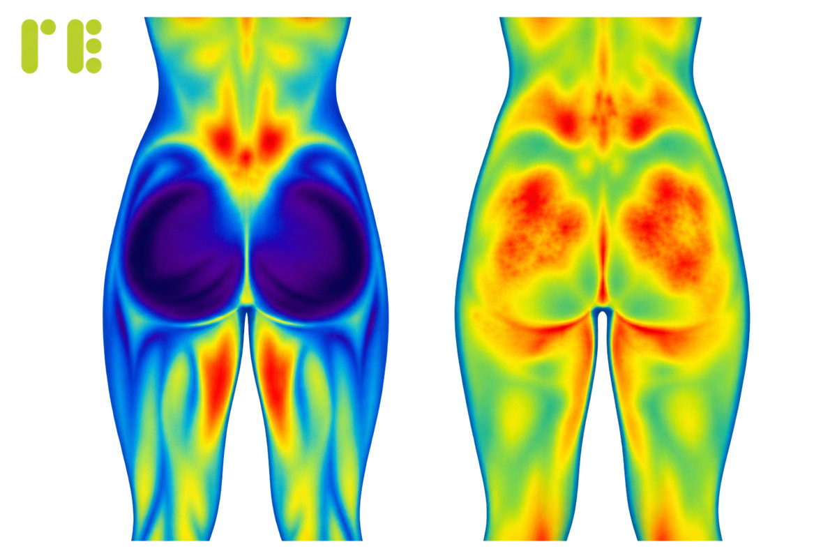 Sitting is the New Smoking, and Your Glutes Are Taking the Hit. Here’s what you can do to reverse the damage.